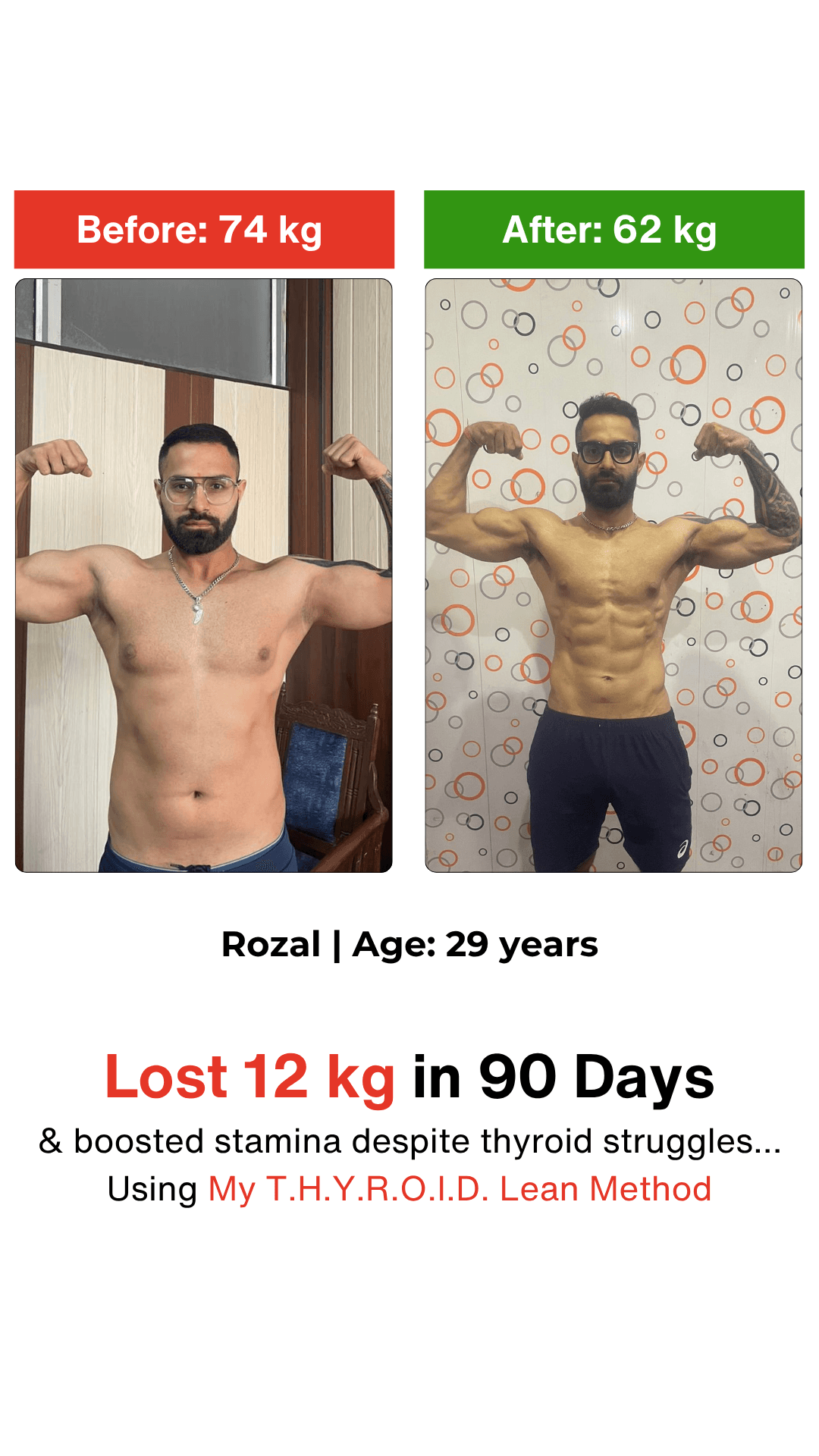 Nehamia R. thyroid transformation