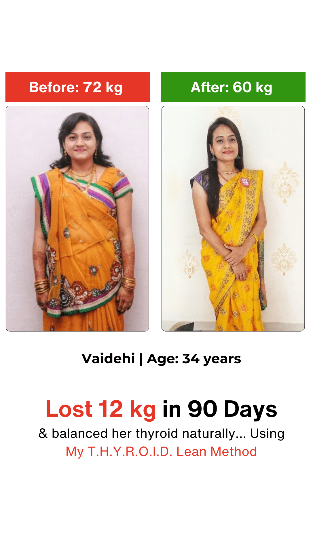 Vaidehi - Before and After Thyroid Transformation