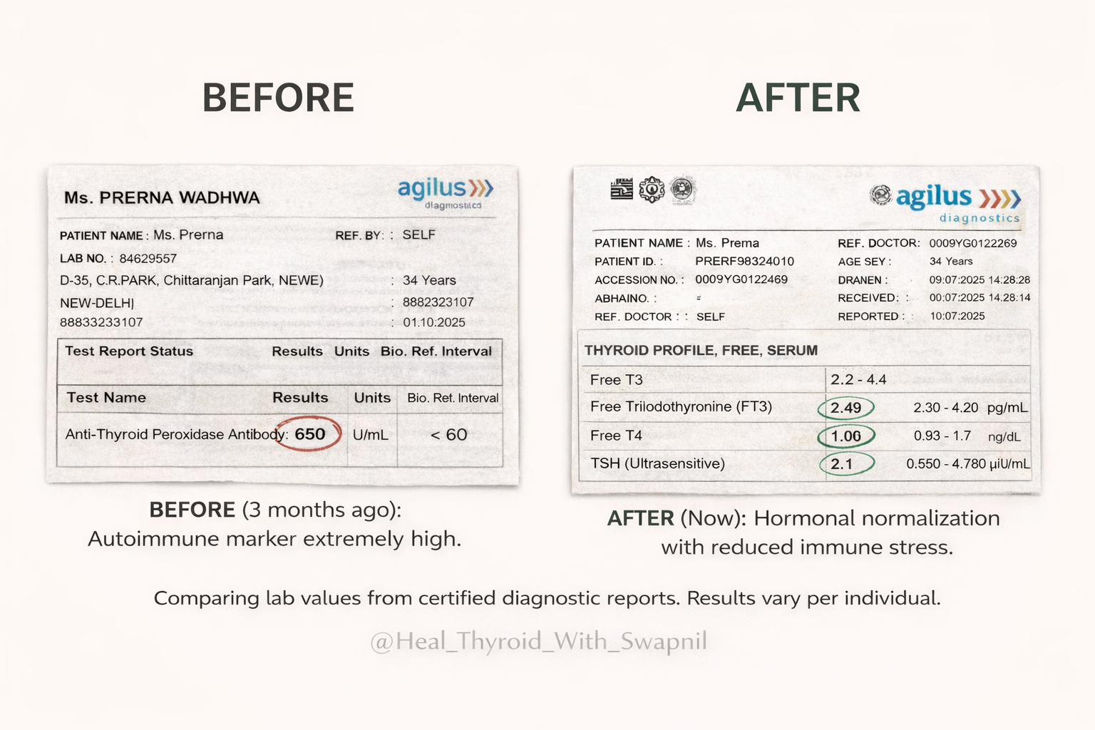 Prerna Wadhwa Before After Thyroid Lab Report